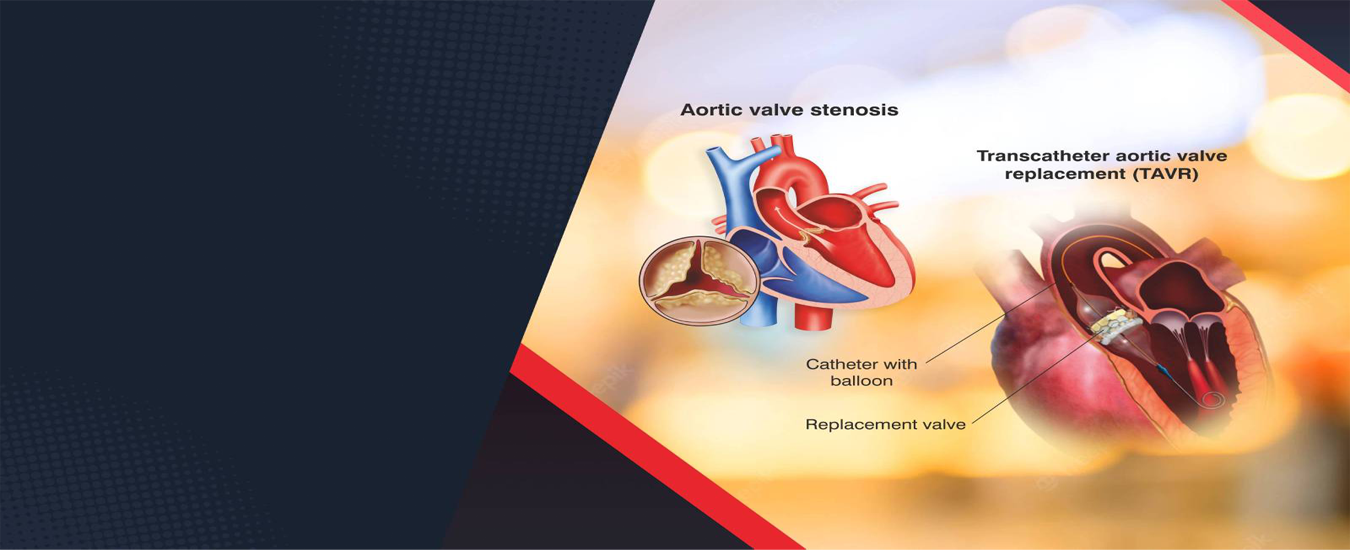 best cardiologist in india