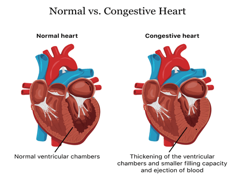 percutaneous valve implantation including tavi