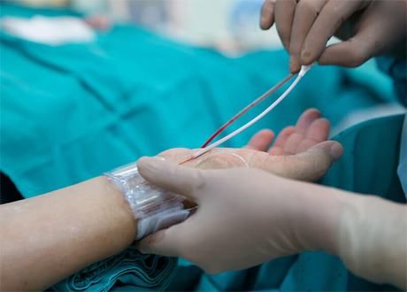 coronar angiography treatment
